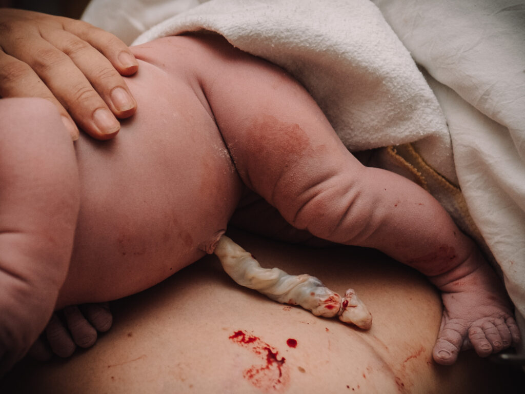 Baby on mom's chest with freshly cut umbilical cord