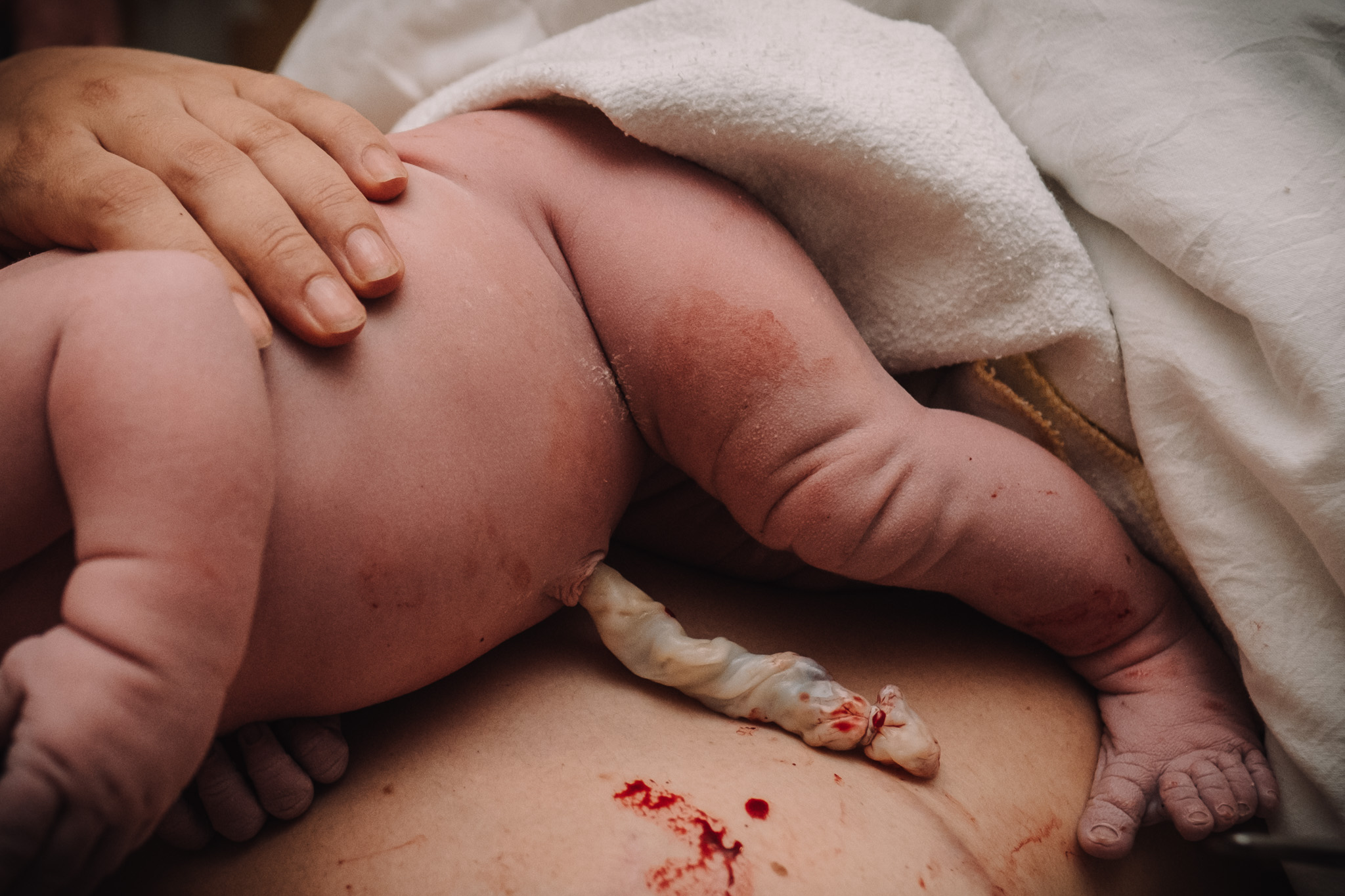 Newborn with freshly cut umbilical cord